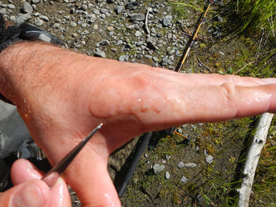 ADF&G employee showing several scales from a salmon on his hand.