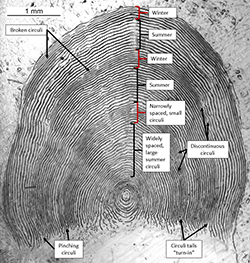 Magnified scale showing annulus features